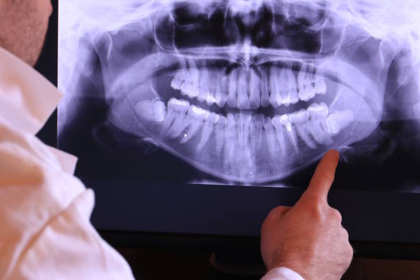 Best Urgent Care for Lost Fillings or Crowns in Shenandoah, LA