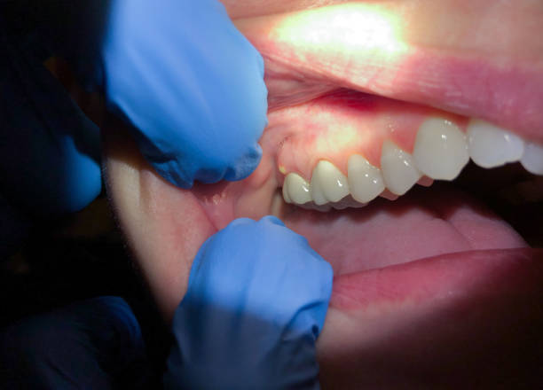 Best Same-Day Emergency Dental Services in Shenandoah, LA