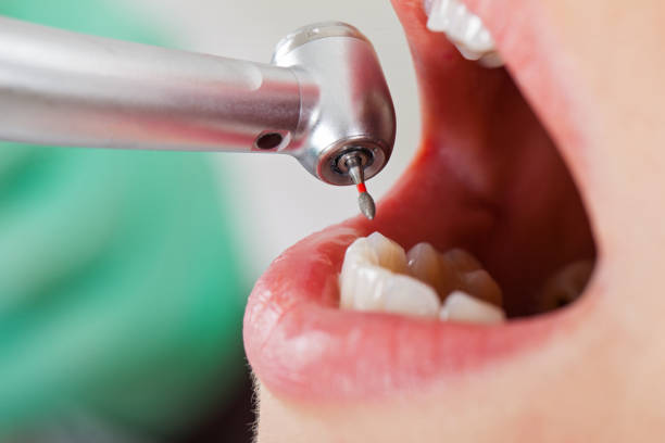 Best Pediatric Emergency Dentist in Shenandoah, LA
